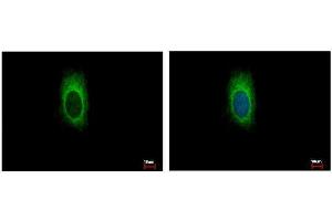 ICC/IF Image ZDHHC13 antibody [C3], C-term detects ZDHHC13 protein at cytoplasm by immunofluorescent analysis. (ZDHHC13 antibody  (C-Term))