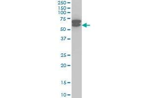 ETV6 monoclonal antibody (M01), clone 3B10 Western Blot analysis of ETV6 expression in Jurkat . (ETV6 antibody  (AA 1-452))