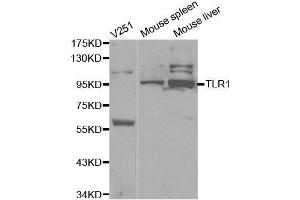 TLR1 antibody  (AA 30-290)