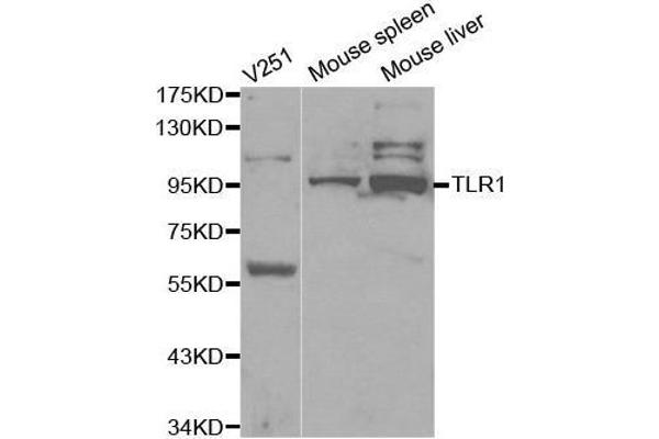 TLR1 antibody  (AA 30-290)