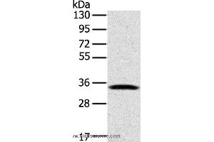 Western blot analysis of Mouse lung tissue, using STX11 Polyclonal Antibody at dilution of 1:400 (Syntaxin 11 antibody)