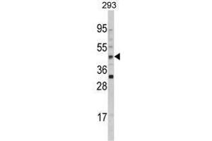 Image no. 1 for anti-Arylacetamide Deacetylase (Esterase) (AADAC) (C-Term) antibody (ABIN452700) (AADAC antibody  (C-Term))