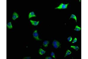 Immunofluorescence staining of A549 cells with ABIN7140223 at 1:50, counter-stained with DAPI. (CACNG6 antibody  (AA 22-39))