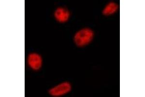 ABIN6275393 staining HepG2 by IF/ICC. (PRPF18 antibody  (Internal Region))