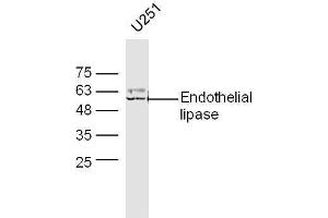 U251 lysates probed with Anti-Endothelial lipase Polyclonal Antibody, Unconjugated  at 1:5000 90min in 37˚C.