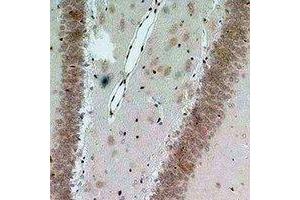 Immunohistochemical analysis of Bestrophin-2 staining in rat brain formalin fixed paraffin embedded tissue section. (Bestrophin 2 antibody)