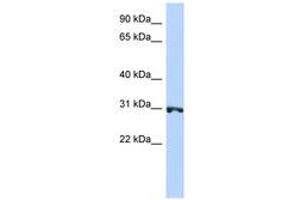 Image no. 1 for anti-Ring Finger Protein 126 (RNF126) (AA 71-120) antibody (ABIN6740804) (RNF126 antibody  (AA 71-120))