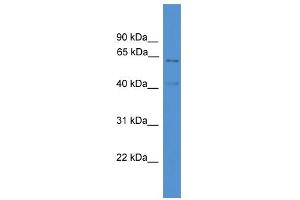 WB Suggested Anti-ACADVL Antibody Titration: 0. (ACADVL antibody  (C-Term))