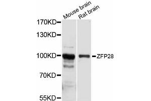 Western blot analysis of extracts of various cell lines, using ZFP28 antibody (ABIN6293840) at 1:1000 dilution. (ZFP28 antibody)