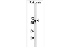 GAD2 Antibody ABIN1539900 western blot analysis in rat brain tissue lysates (35 μg/lane). (GAD65 antibody  (AA 109-138))