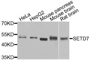 Western blot analysis of extracts of various cell lines, using SETD7 antibody. (SETD7 antibody  (AA 1-366))