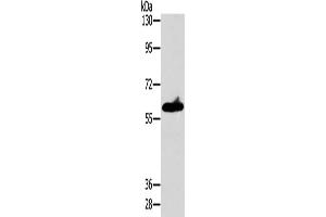 Gel: 8 % SDS-PAGE, Lysate: 40 μg, Lane: A549 cells, Primary antibody: ABIN7128549(ASB3 Antibody) at dilution 1/200, Secondary antibody: Goat anti rabbit IgG at 1/8000 dilution, Exposure time: 10 seconds (ASB3 antibody)