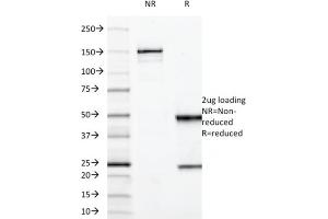 SDS-PAGE Analysis Purified MUC3 Mouse Monoclonal Antibody (M3. (MUC3A antibody)