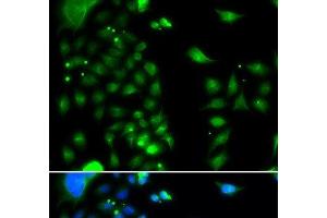 Immunofluorescence analysis of MCF-7 cells using UBE2J2 Polyclonal Antibody (UBE2J2 antibody)