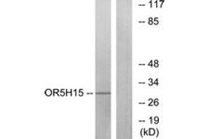 Western blot analysis of extracts from COLO cells, using OR5H15 Antibody. (OR5H15 antibody  (AA 241-290))