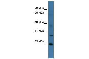 Western Blot showing STARD4 antibody used at a concentration of 1-2 ug/ml to detect its target protein. (STARD4 antibody  (Middle Region))