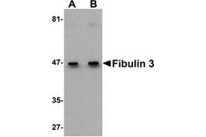 Western Blotting (WB) image for anti-Fibulin 3 (FBLN3) (C-Term) antibody (ABIN1030395) (FBLN3 antibody  (C-Term))