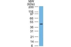 Western blot of HeLa lysate using CK17 Monoclonal Antibody (SPM560). (KRT17 antibody)