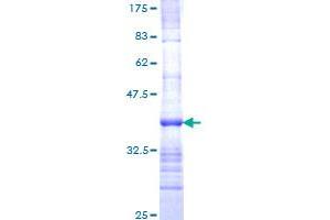 SCN8A Protein (AA 1854-1951) (GST tag)