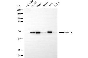 Western blotting analysis using SHMT1 antibody (ABIN7800301).