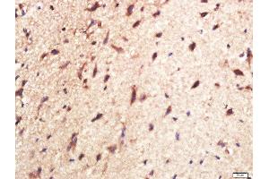 Paraformaldehyde-fixed, paraffin embedded mouse brain tissue, Antigen retrieval by boiling in sodium citrate buffer(pH6) for 15min, Block endogenous peroxidase by 3% hydrogen peroxide for 30 minutes, Blocking buffer (normal goat serum) at 37°C for 20min, Antibody incubation with Rabbit Anti-CPLX1 Polyclonal Antibody, Unconjugated  at 1:400 overnight at 4°C, followed by a conjugated secondary and DAB staining (Complexin 1 antibody  (AA 31-100))