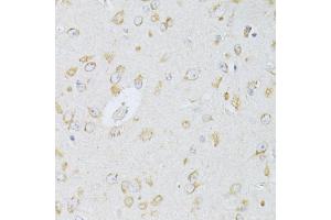 Immunohistochemistry of paraffin-embedded rat brain using NTS antibody (ABIN5998396) at dilution of 1/100 (40x lens). (Neurotensin antibody)