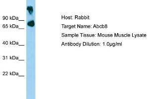 WB Suggested Anti-Abcb8 Antibody   Titration: 1. (ABCB8 antibody  (Middle Region))