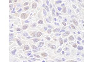 Immunohistochemistry (IHC) image for anti-RAD50 Homolog (S. Cerevisiae) (RAD50) (AA 700-750) antibody (ABIN7448751) (RAD50 antibody  (AA 700-750))