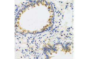 Immunohistochemistry of paraffin-embedded rat lung using UVRAG antibody at dilution of 1:100 (x40 lens).