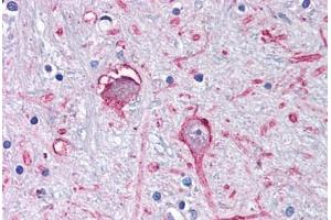 Anti-GABRA3 antibody  ABIN1048638 IHC staining of human brain, globus pallidus. (GABRA3 antibody  (C-Term))