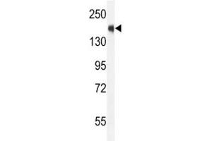 SRC-1 antibody western blot analysis in CEM lysate. (NCOA1 antibody  (AA 1338-1367))