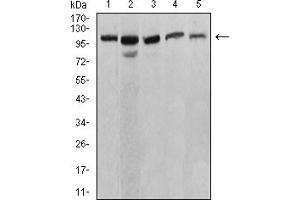 Western blot analysis using ATP2A1 mouse mAb against C2C12 (1), COS7 (2), Hela (3), K562 (4), and Jurkat (5) cell lysate. (ATP2A1/SERCA1 antibody  (AA 487-631))