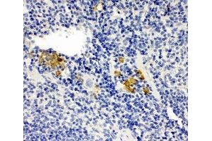 IHC-P: Leupaxin antibody testing of mouse spleen tissue