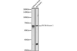 Western blot analysis of extracts of various cell lines, using p70 S6 Kinase 1 1 antibody (ABIN7270029) at 1:1000 dilution. (RPS6KB1 antibody  (AA 361-525))