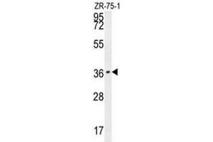 CLEC12A Antibody (Center) western blot analysis in ZR-75-1 cell line lysates (35µg/lane). (CLEC12A antibody  (Middle Region))