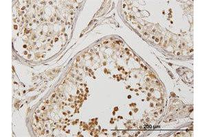 Immunoperoxidase of purified MaxPab antibody to DYX1C1 on formalin-fixed paraffin-embedded human testis. (DYX1C1 antibody  (AA 1-381))