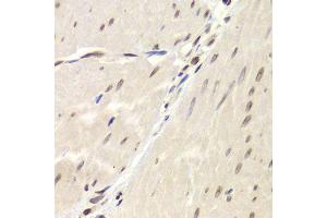 Immunohistochemistry (Paraffin-embedded Sections) (IHC (p)) image for anti-X-Ray Repair Complementing Defective Repair in Chinese Hamster Cells 6 (XRCC6) (AA 500-600) antibody (ABIN1513143)