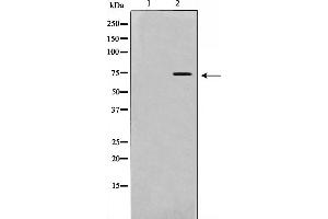 Western Blotting (WB) image for anti-Interleukin 2 Receptor, beta (IL2RB) (Internal Region) antibody (ABIN6262526)