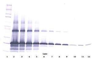Image no. 1 for anti-WNT1 Inducible Signaling Pathway Protein 2 (WISP2) antibody (ABIN465385) (WISP2 antibody)