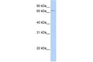 WB Suggested Anti-GLMN Antibody Titration: 0. (GLMN antibody  (N-Term))