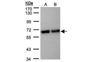 WB Image Sample(30 μg of whole cell lysate) A:Hep G2, B:MOLT4, 7. (STIP1 antibody)