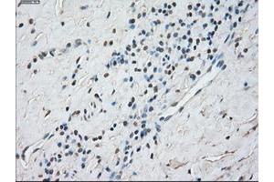 Image no. 4 for anti-Signal Transducer and Activator of Transcription 1, 91kDa (STAT1) antibody (ABIN1501169)
