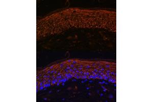 Immunofluorescence analysis of Mouse skin using  Rabbit pAb (ABIN6134303, ABIN6136434, ABIN6136435 and ABIN6216449) at dilution of 1:100. (CXCR7 antibody  (AA 50-150))