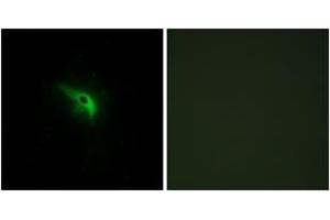 Immunofluorescence analysis of A549 cells, using TPIP1 Antibody. (TP53AIP1 antibody  (AA 75-124))