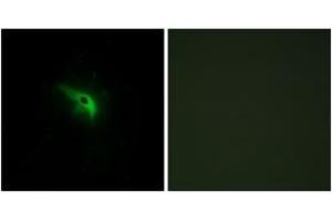 Immunofluorescence analysis of A549 cells, using TPIP1 Antibody.