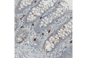 Immunohistochemical staining (Formalin-fixed paraffin-embedded sections) of human colon with KIT monoclonal antibody, clone CL1667  shows strong immunoreactivity in some lymphoid cells. (KIT antibody  (AA 50-190))