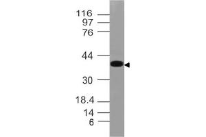 Image no. 1 for anti-N-Myc Downstream Regulated 1 (NDRG1) (AA 123-318) antibody (ABIN5027496) (NDRG1 antibody  (AA 123-318))