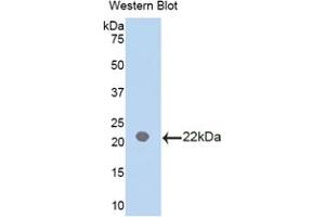 Western blot analysis of the recombinant protein. (IL18BP antibody  (AA 29-193))