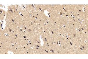 Detection of PDGF BB in Porcine Cerebrum Tissue using Polyclonal Antibody to Platelet Derived Growth Factor BB (PDGF BB) (PDGF-BB Homodimer (AA 82-190) antibody)