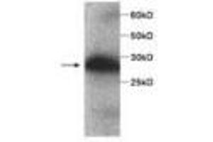 Image no. 1 for anti-serpin Peptidase Inhibitor, Clade B (Ovalbumin), Member 4 (SERPINB4) antibody (ABIN791515) (SERPINB4 antibody)